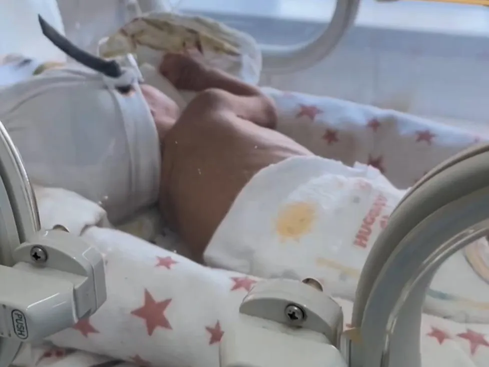 Новорождённого весом 850 граммов выходили казахстанские врачи