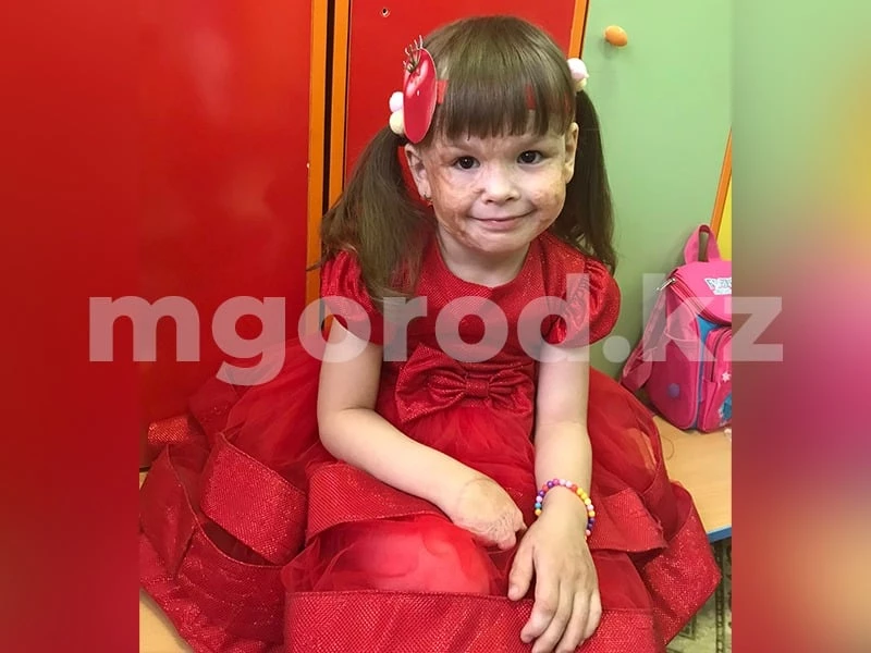 Девочка из Уральска перенесла восемь операций