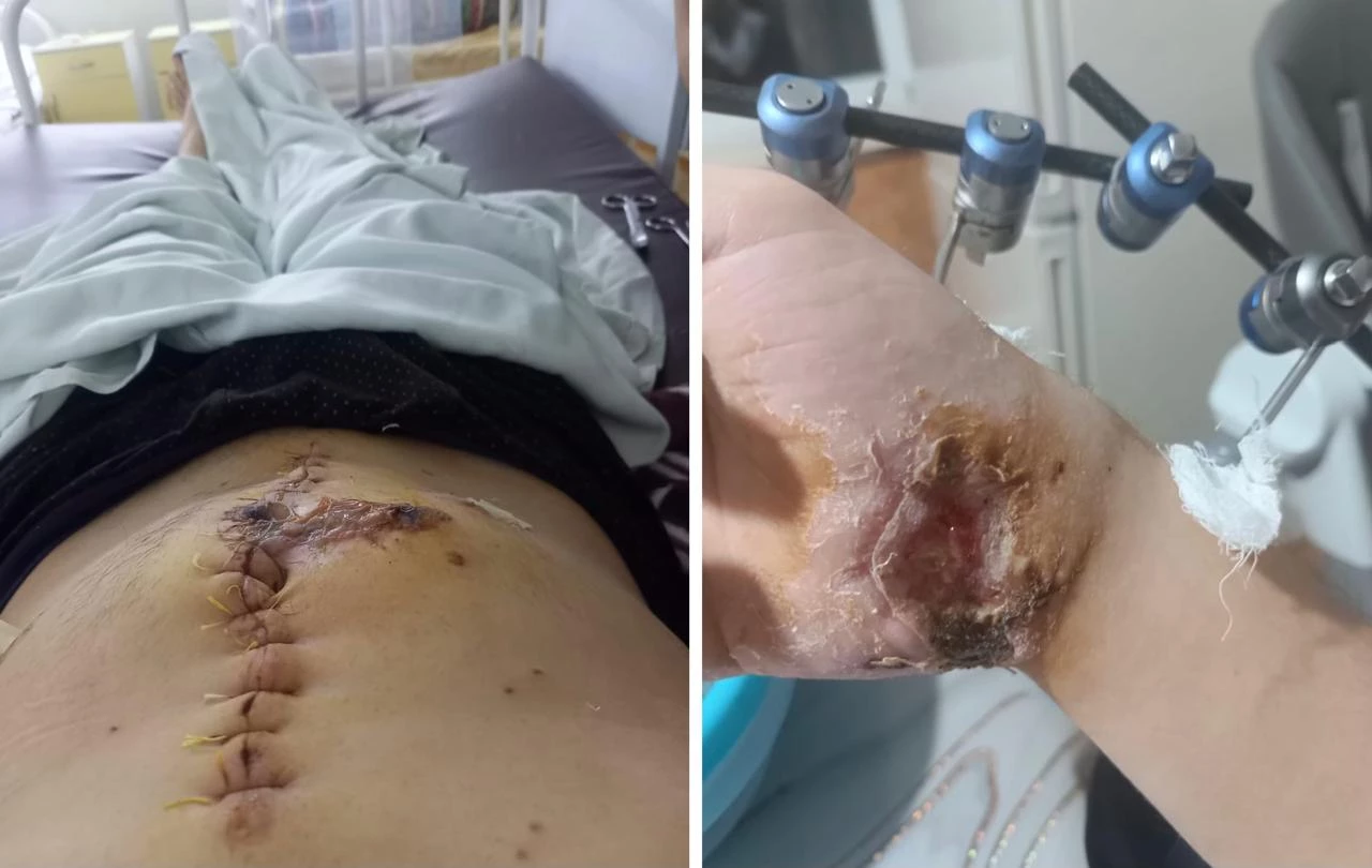 Житель Уральска получил огнестрельное ранение у себя во дворе