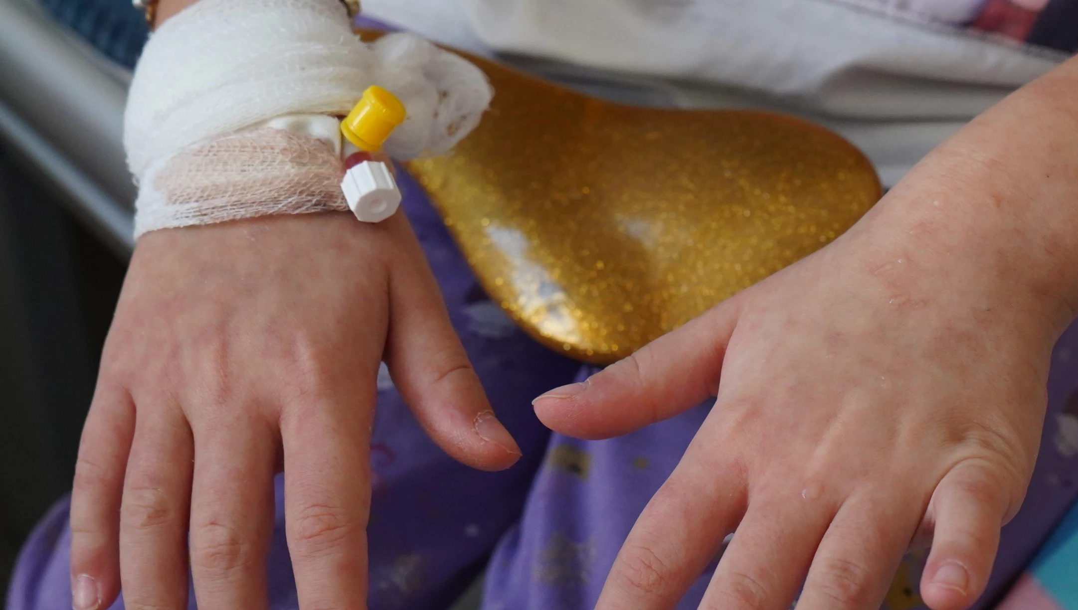 На что у жителей ЗКО чаще всего аллергия и какие анализы можно сдать бесплатно