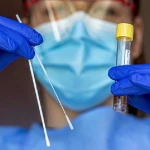 Угрожает ли Казахстану вирус Марбург - Минздрав