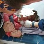 Собаки напали на пятилетнего ребенка в Бурлинском районе