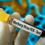 Вспышка вируса Марбург: Минздрав Казахстана усиливает контроль