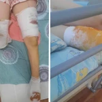 Девочку из Уральска переехал тепловоз. Ей ампутировали ногу.