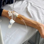 Врачи бьют тревогу: 650 женщин в ЗКО стоят на учете с раком шейки матки