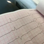 Более 94 тысяч жителей ЗКО состоят на учете с болезнями сердца