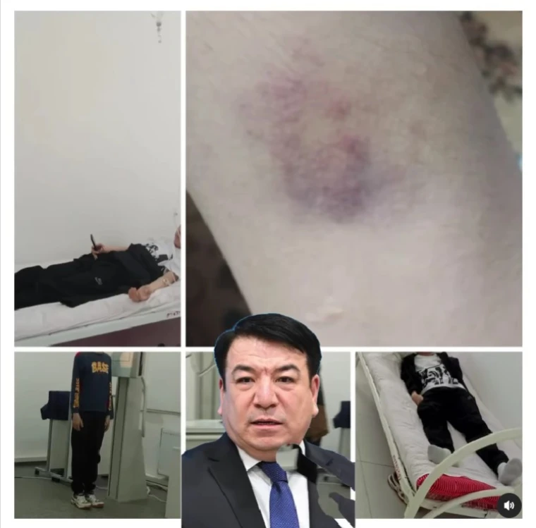Подростка жестоко избили одноклассники в Атырауской области | Мой Город Подростка жестоко избили одноклассники в Атырауской области