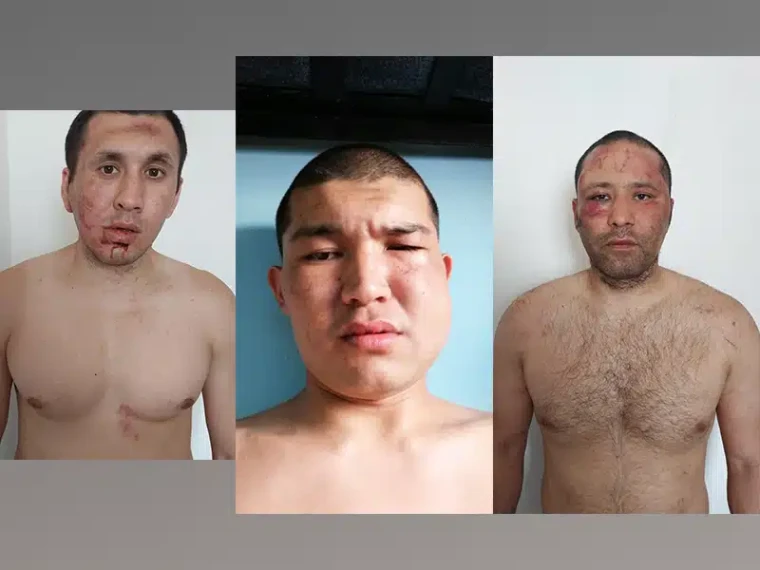 «Заявили об избиении»: 11 заключённых доставили в больницу Уральска | Мой Город «Заявили об избиении»: 11 заключённых доставили в больницу Уральска