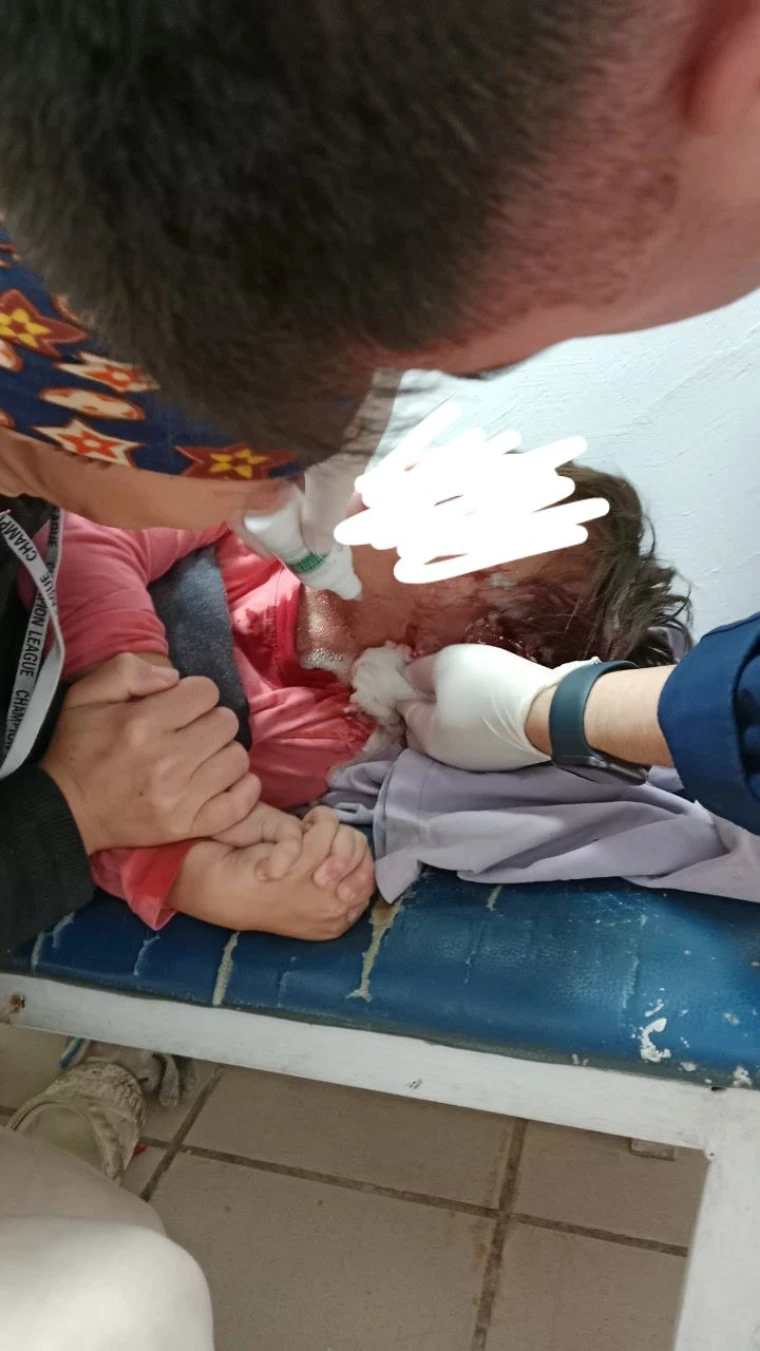 Собаки напали на пятилетнего ребенка в Бурлинском районе | Мой Город Собаки напали на пятилетнего ребенка в Бурлинском районе