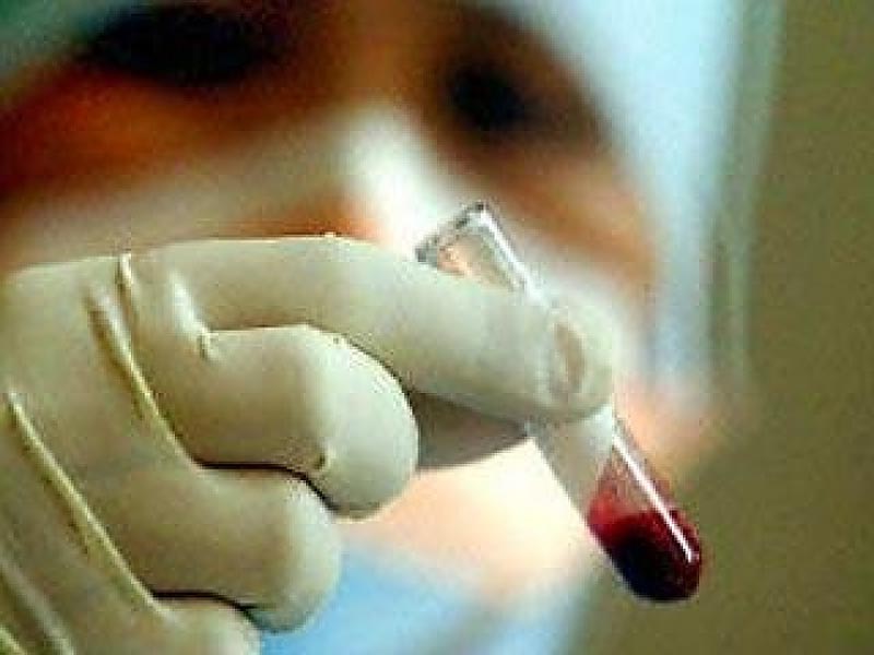 В ЗКО вспышки бруцеллеза среди людей нет