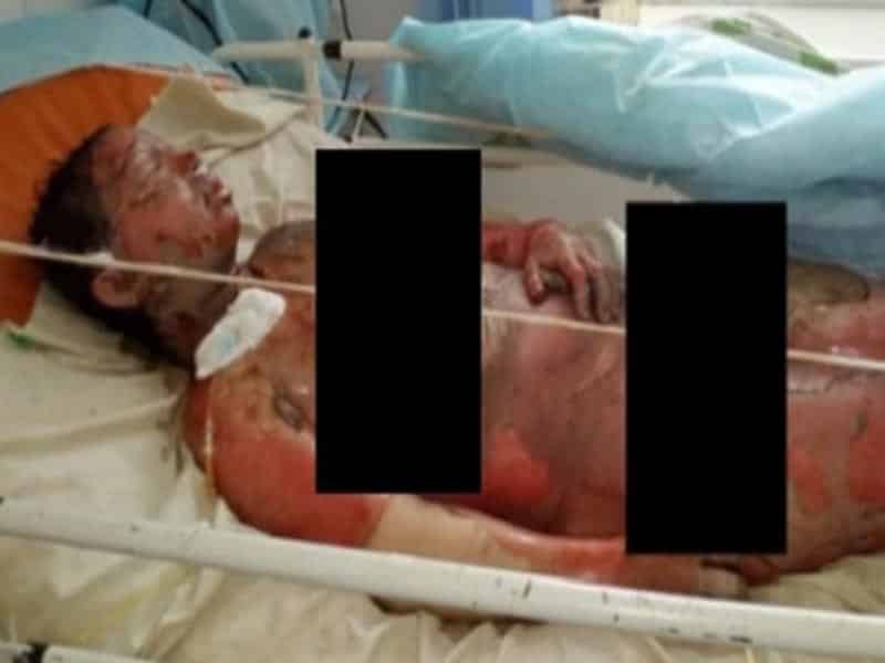 В Актобе односельчане и солдаты сдают кровь для обожженной матери шестерых детей