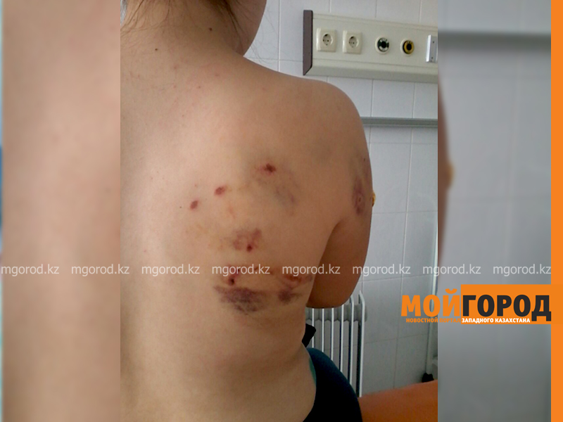 Бродячая собака покусала школьницу в Уральске
