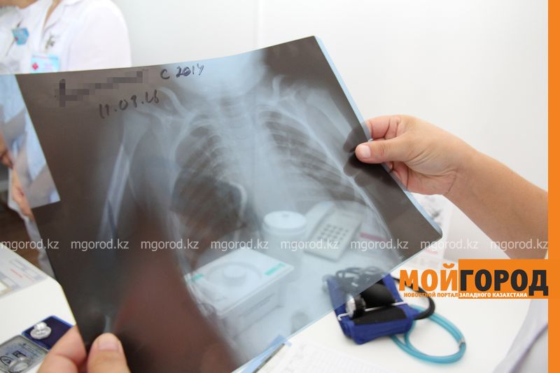 В ЗКО туберкулезом заразились двое непривитых детей