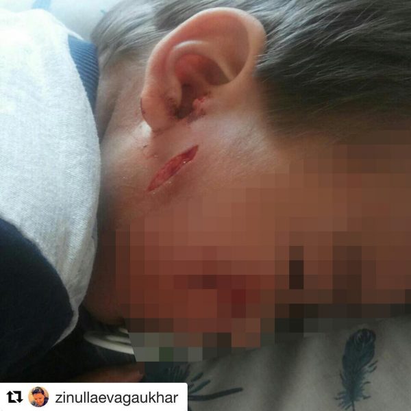 В Атырау оштрафовали хозяина собаки, покусавшей ребенка
