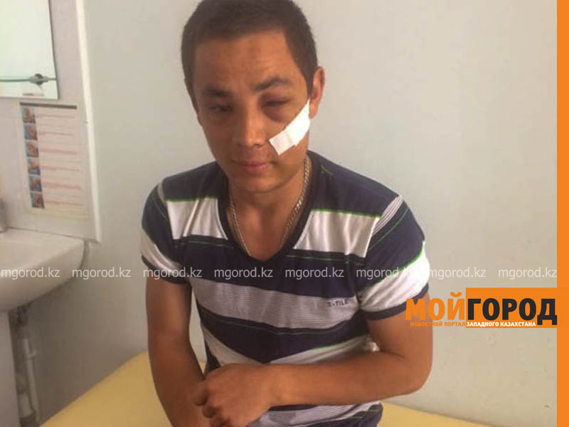 Раненому в лицо парню из Уральска провели уникальную операцию