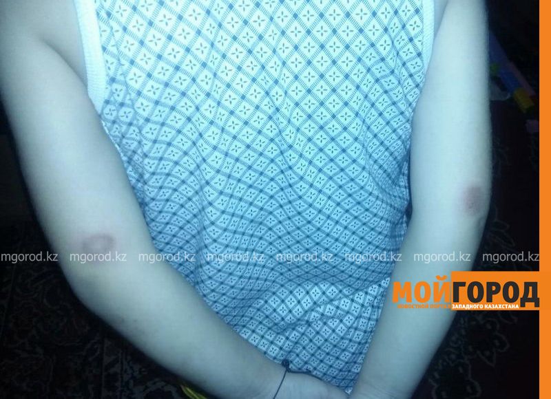 В Уральске во время подготовки к осеннему балу в детсаду ребенок получил ссадины и ушибы