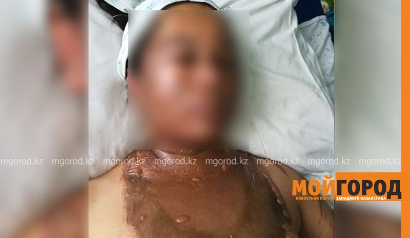 В Мангистауской области 30-летний мужчина опрокинул котел с кипящим маслом на лицо продавцу