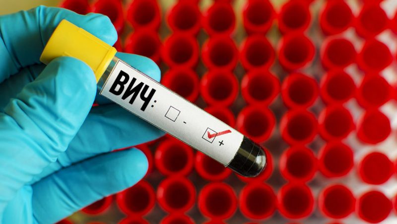 В Атырауской области зарегистрировано 25 ВИЧ-инфицированных людей