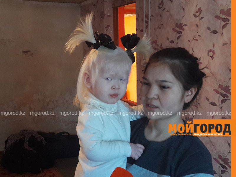 В Уральске родители девочки-альбиноса просят помочь им с жильем