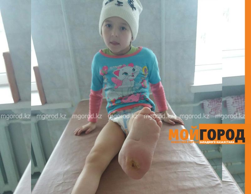 Маленькой Насте из Уральска требуются деньги на повторную операцию