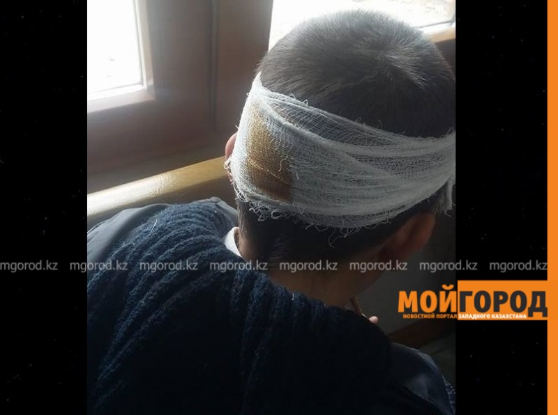 В Атырау неизвестные бросили камень в голову ребенка