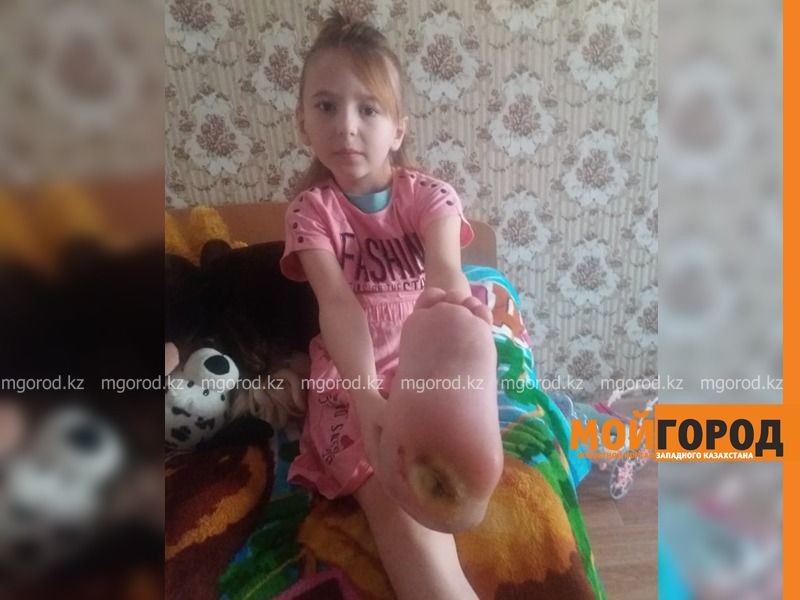 110 тысяч тенге не хватает на лечение маленькой девочки из Уральска