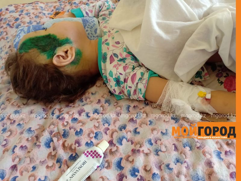 Водитель иномарки дважды проехал по 3-летней девочке в Уральске (фото)
