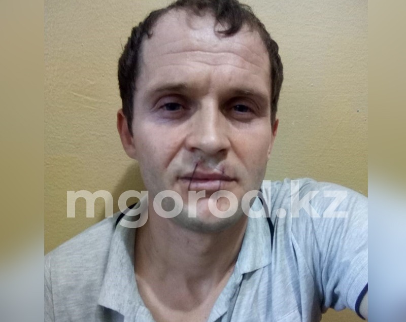 Обвиняемый в краже и угоне зашил себе рот в знак протеста следствия в Уральске