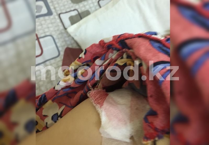 Мужчина вонзил нож в спину супруге в Атырау: женщину выписали из больницы