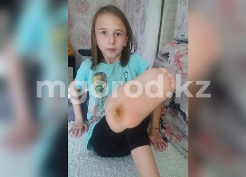 У больной девочки из Уральска высыхает нога