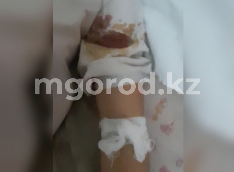 В Атырау бродячие собаки покусали школьницу. Девочка в тяжелом состоянии