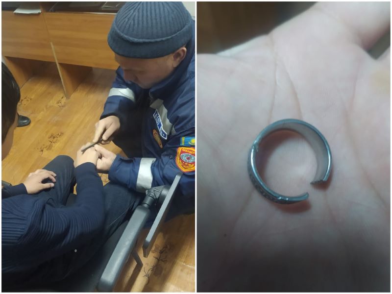 Спасатели сняли кольцо с опухшего пальца подростка в Атырауской области