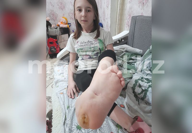 Полмиллиона тенге собрали казахстанцы на лечение девочки со спинномозговой грыжей из Уральска