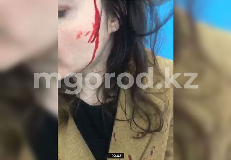 Женщина получила травму головы в детском развлекательном центре Уральска