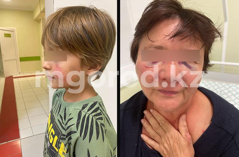 Пожилую иностранку с внуком избил житель ЗКО