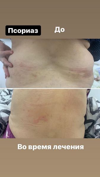 Победить рак возможно даже на крайних стадиях