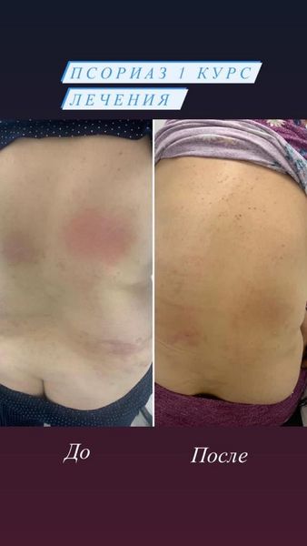 Победить рак возможно даже на крайних стадиях